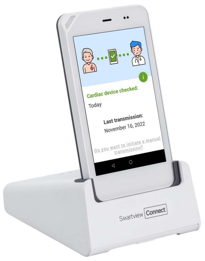 SmartView Connect?